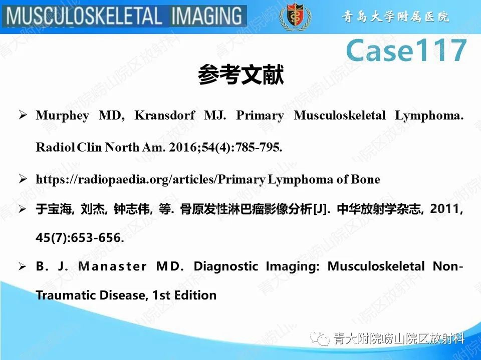 影像PPT - 【PPT】原发性骨淋巴瘤-29
