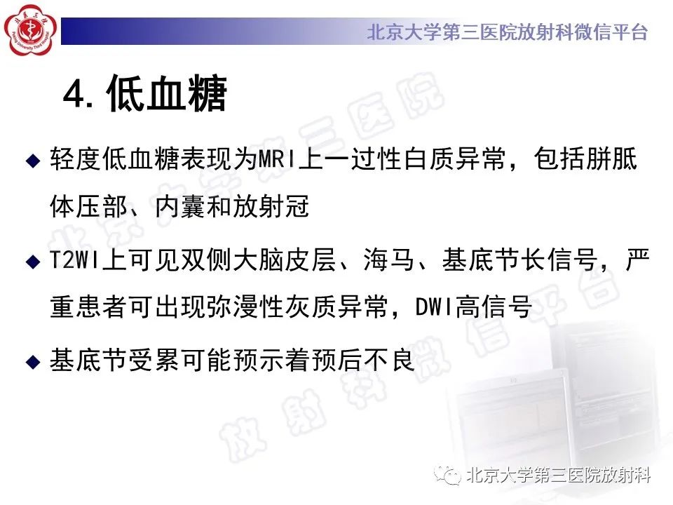 影像PPT - 【PPT】基底节区与丘脑对称性病变-20