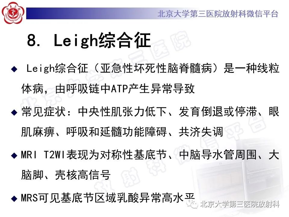 影像PPT - 【PPT】基底节区与丘脑对称性病变-28