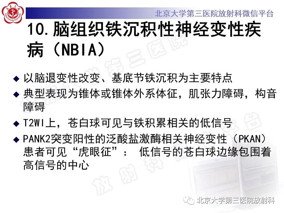 影像PPT - 【PPT】基底节区与丘脑对称性病变-32