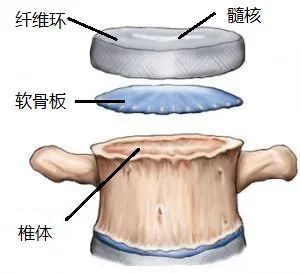 影像PPT - 椎体终板炎发生机制、分型以及 MRI 表现-2 影像PPT - 椎体终板炎发生机制、分型以及 MRI 表现-2