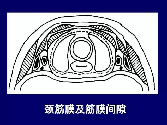 影像PPT - 【PPT】颈部和喉的断层解剖-9