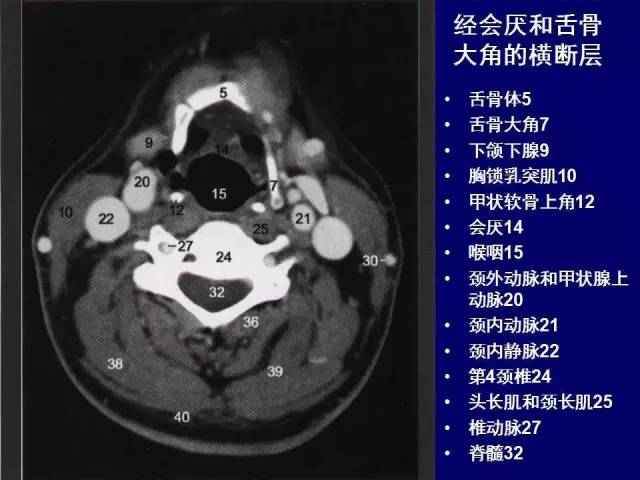 影像PPT - 【PPT】颈部和喉的断层解剖-20
