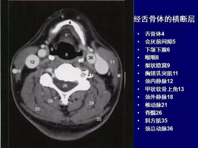 影像PPT - 【PPT】颈部和喉的断层解剖-21