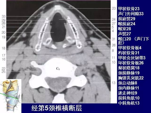 影像PPT - 【PPT】颈部和喉的断层解剖-51