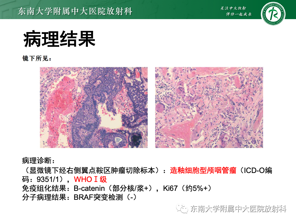 影像PPT - 【PPT】颅咽管瘤-5