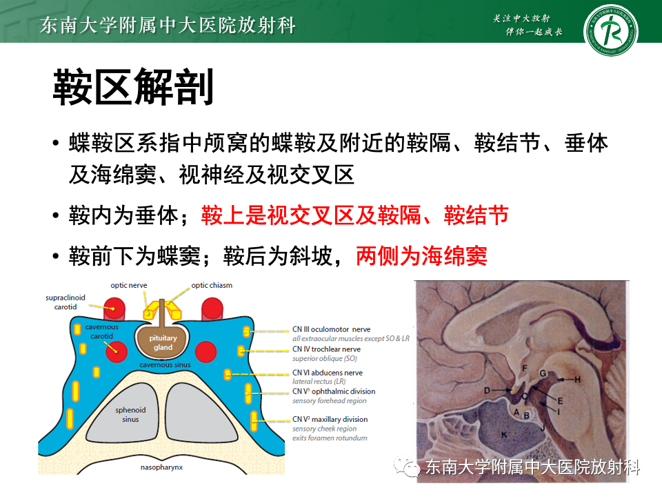 影像PPT - 【PPT】颅咽管瘤-7