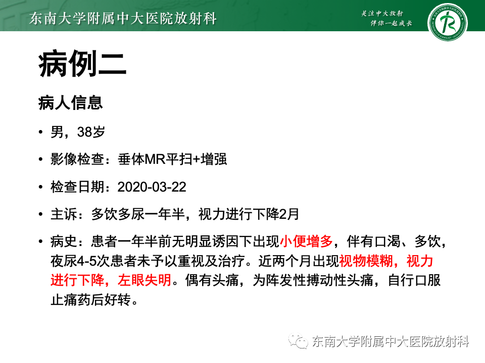 影像PPT - 【PPT】颅咽管瘤-15