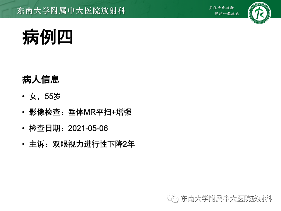 影像PPT - 【PPT】颅咽管瘤-29