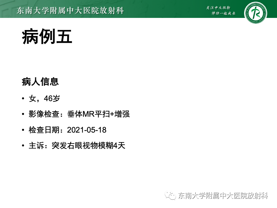 影像PPT - 【PPT】颅咽管瘤-33