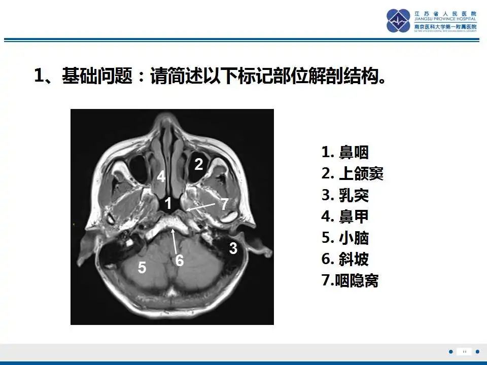 影像PPT - 【PPT】鼻咽癌-12
