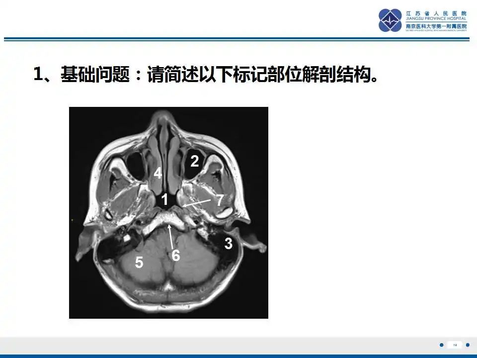 影像PPT - 【PPT】鼻咽癌-11