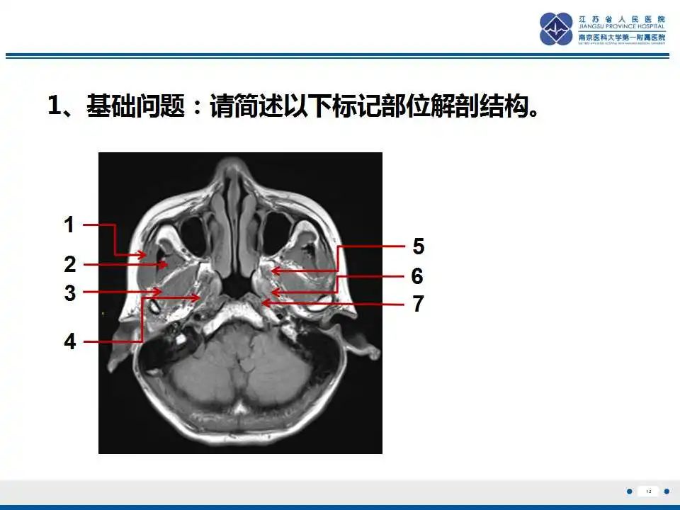 影像PPT - 【PPT】鼻咽癌-13