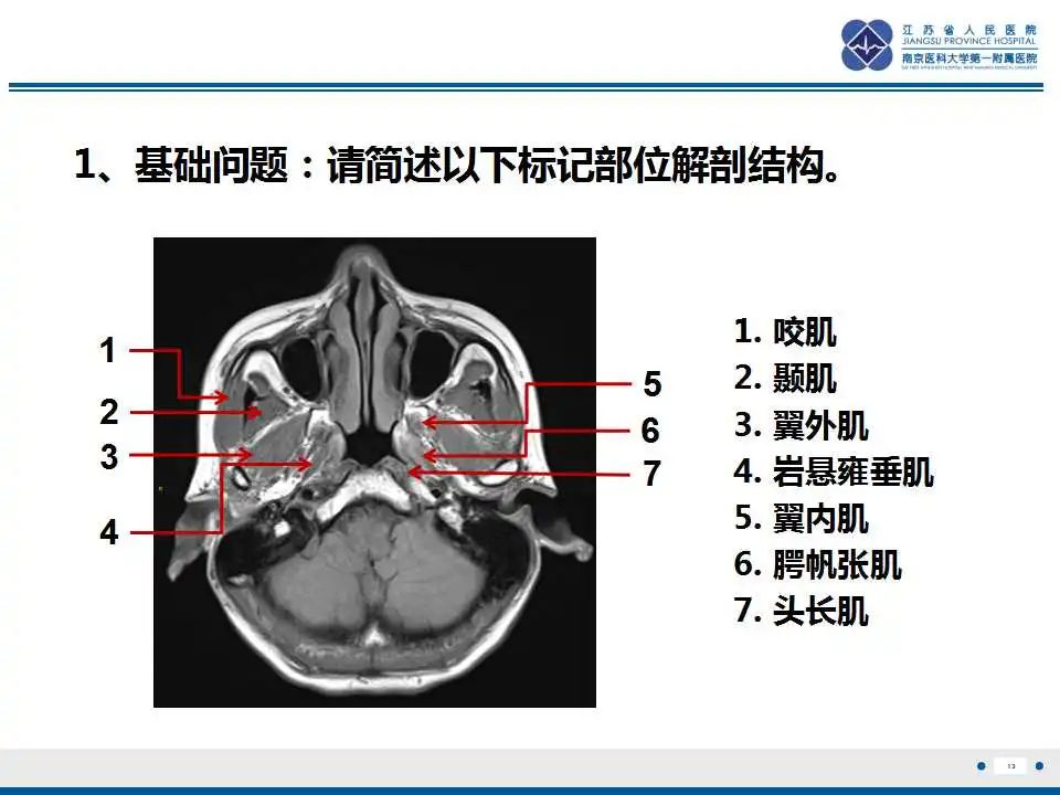 影像PPT - 【PPT】鼻咽癌-14