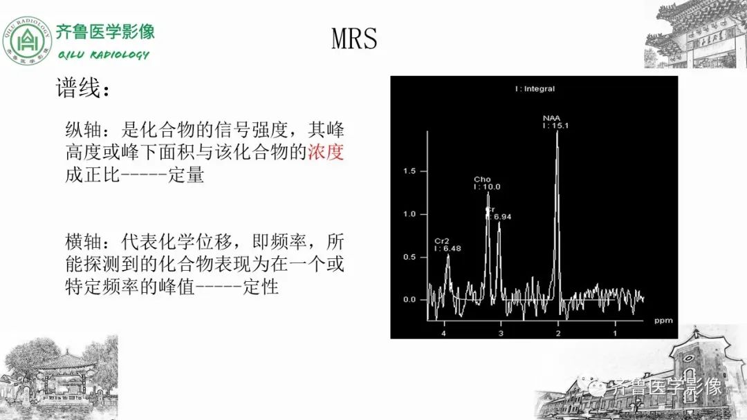 影像PPT - 【PPT】磁共振波谱MRS-4