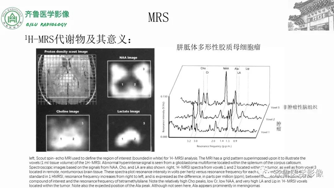 影像PPT - 【PPT】磁共振波谱MRS-10