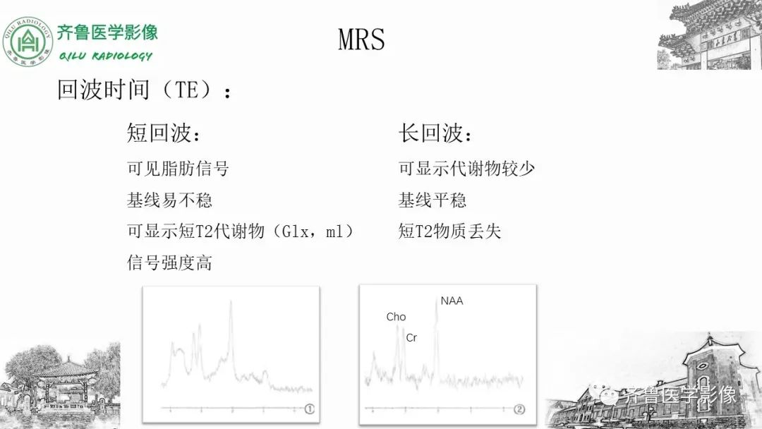 影像PPT - 【PPT】磁共振波谱MRS-12
