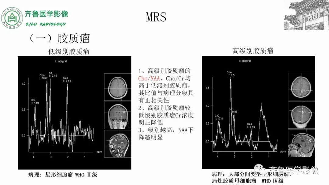 影像PPT - 【PPT】磁共振波谱MRS-15