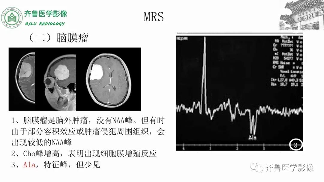 影像PPT - 【PPT】磁共振波谱MRS-16
