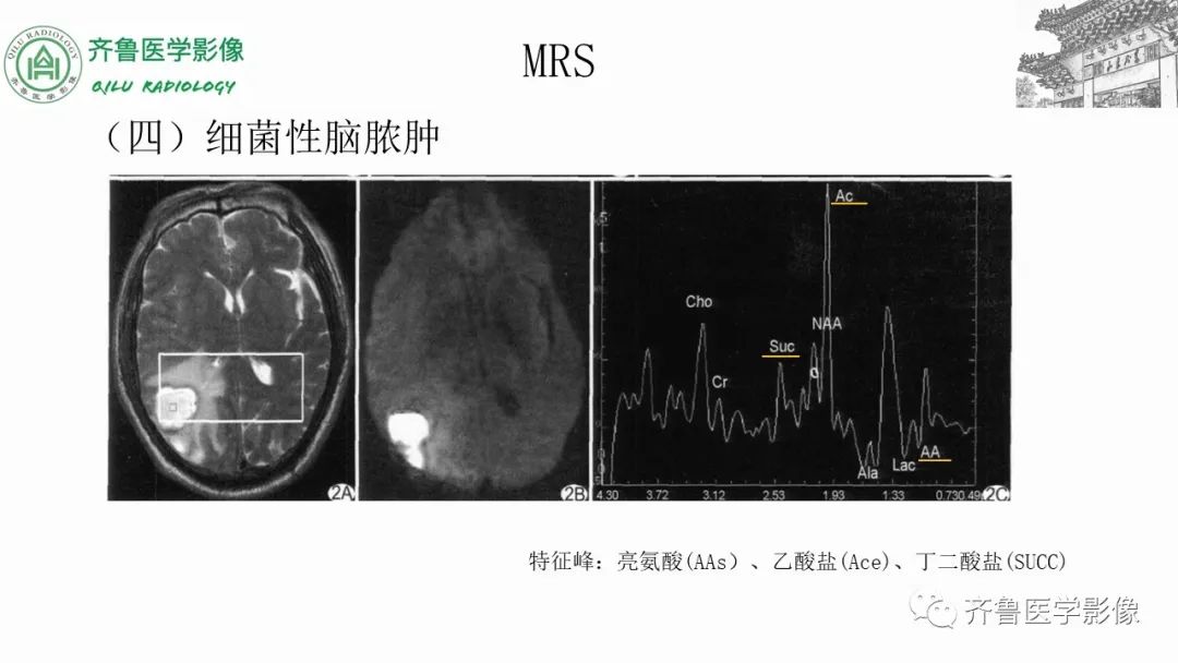 影像PPT - 【PPT】磁共振波谱MRS-18