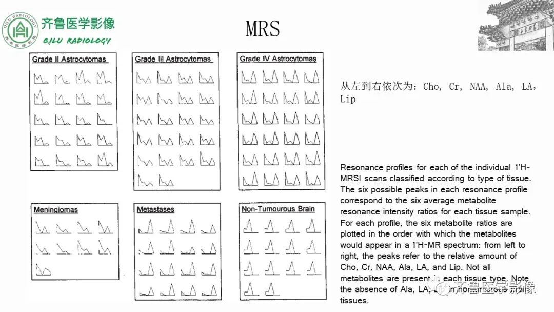 影像PPT - 【PPT】磁共振波谱MRS-21