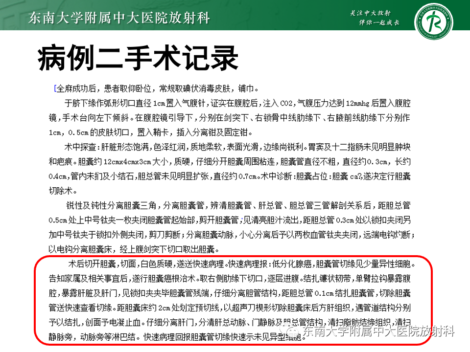 影像PPT - 【PPT】胆囊壁增厚性疾病的影像诊断思路-14 影像PPT - 【PPT】胆囊壁增厚性疾病的影像诊断思路-14