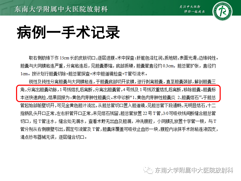 影像PPT - 【PPT】胆囊壁增厚性疾病的影像诊断思路-11 影像PPT - 【PPT】胆囊壁增厚性疾病的影像诊断思路-11