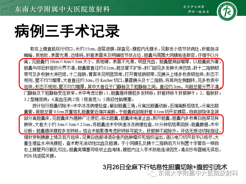 影像PPT - 【PPT】胆囊壁增厚性疾病的影像诊断思路-17 影像PPT - 【PPT】胆囊壁增厚性疾病的影像诊断思路-17