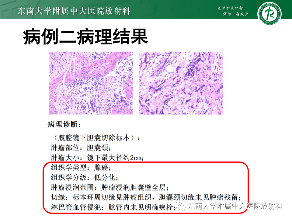 影像PPT - 【PPT】胆囊壁增厚性疾病的影像诊断思路-15 影像PPT - 【PPT】胆囊壁增厚性疾病的影像诊断思路-15