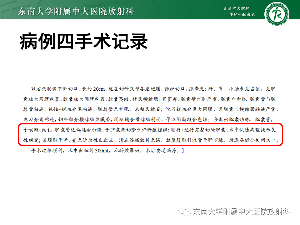 影像PPT - 【PPT】胆囊壁增厚性疾病的影像诊断思路-23 影像PPT - 【PPT】胆囊壁增厚性疾病的影像诊断思路-23