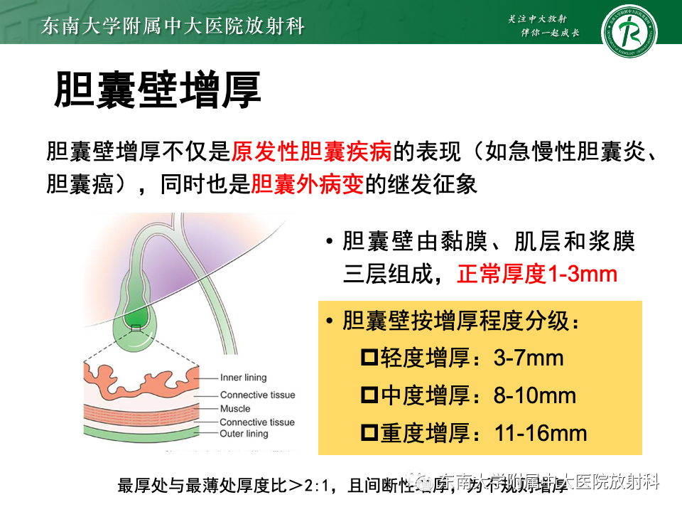 影像PPT - 【PPT】胆囊壁增厚性疾病的影像诊断思路-30 影像PPT - 【PPT】胆囊壁增厚性疾病的影像诊断思路-30