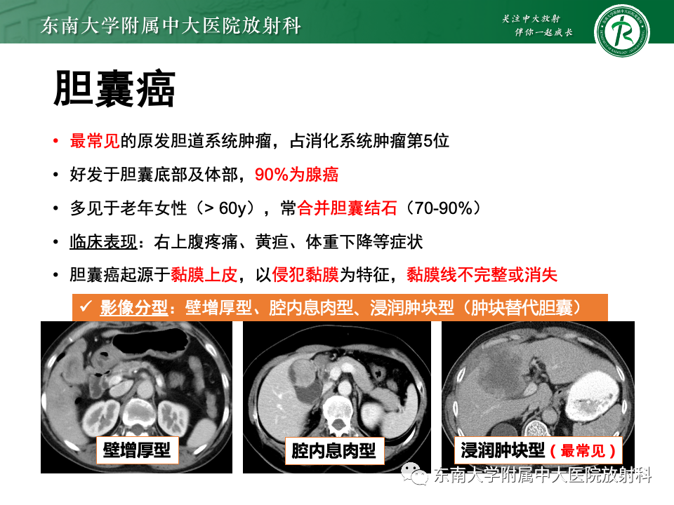 影像PPT - 【PPT】胆囊壁增厚性疾病的影像诊断思路-42 影像PPT - 【PPT】胆囊壁增厚性疾病的影像诊断思路-42