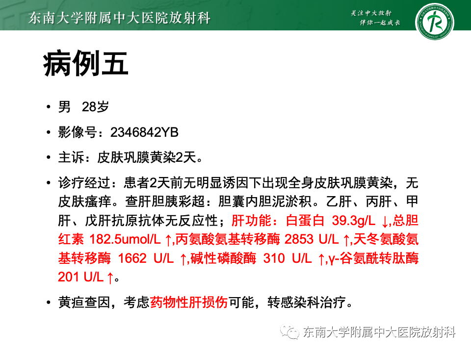 影像PPT - 【PPT】胆囊壁增厚性疾病的影像诊断思路-52 影像PPT - 【PPT】胆囊壁增厚性疾病的影像诊断思路-52