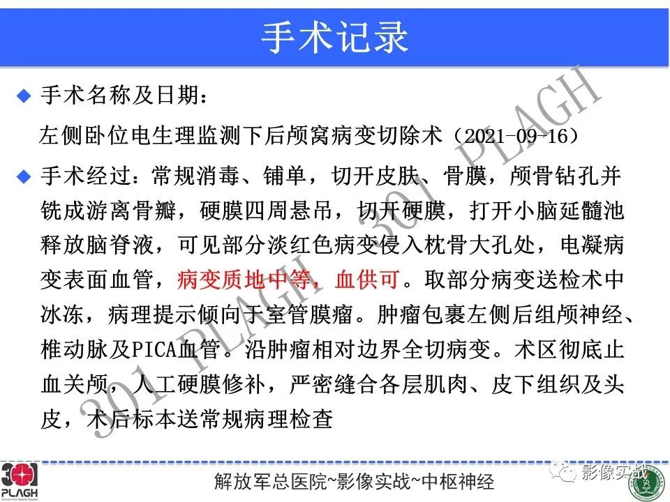 影像PPT - 【病例】幕下室管膜瘤1例MR影像诊断思路-25
