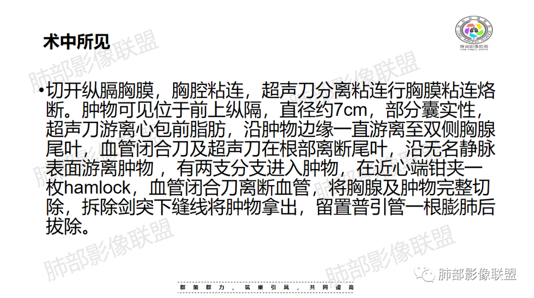 影像PPT - 【病例】前纵隔囊性病变—成熟性畸胎瘤1例CT影像-16