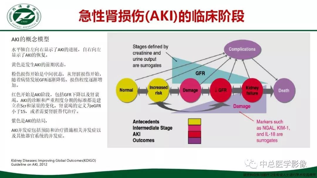 影像PPT - 【PPT】重视对比剂导致的急性肾损伤-4