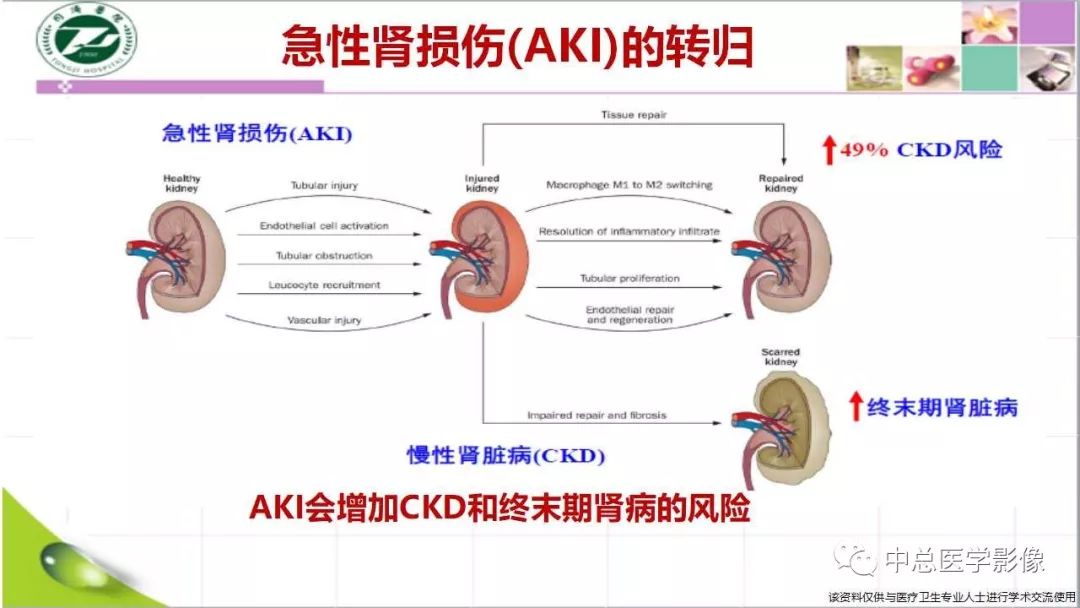 影像PPT - 【PPT】重视对比剂导致的急性肾损伤-5