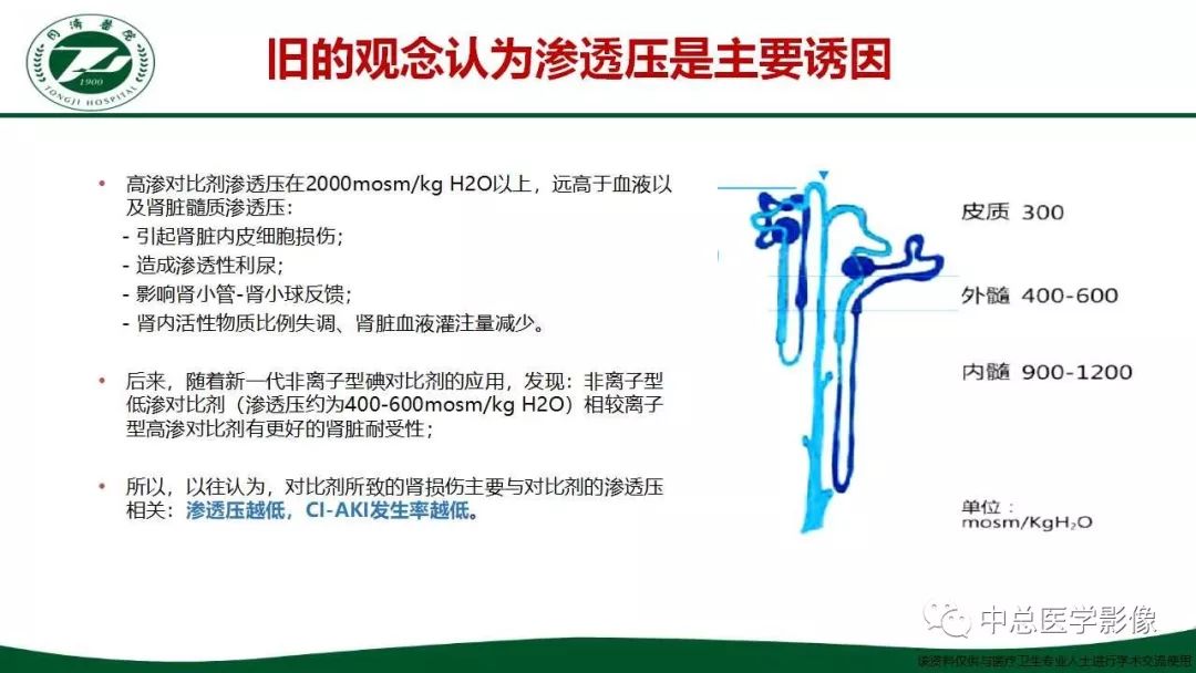 影像PPT - 【PPT】重视对比剂导致的急性肾损伤-11