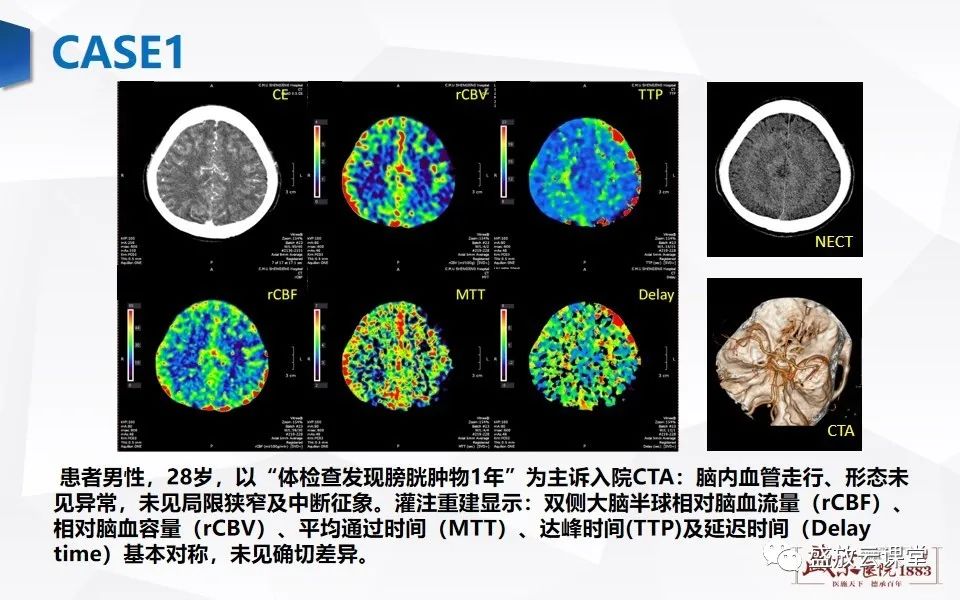 影像PPT - 【PPT】脑CT灌注成像中各测量值的意义-10