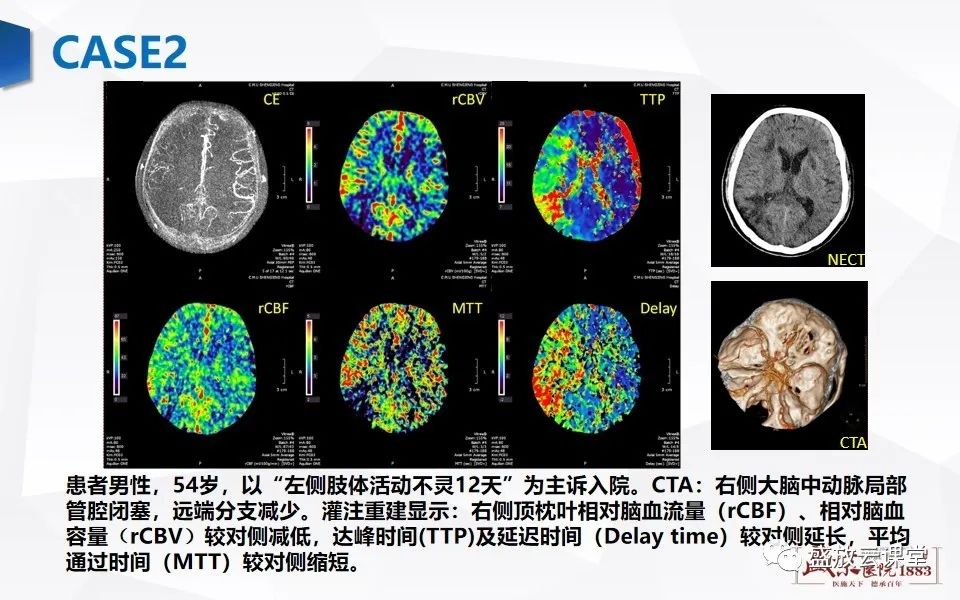 影像PPT - 【PPT】脑CT灌注成像中各测量值的意义-11