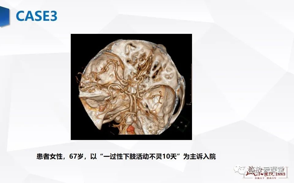 影像PPT - 【PPT】脑CT灌注成像中各测量值的意义-12