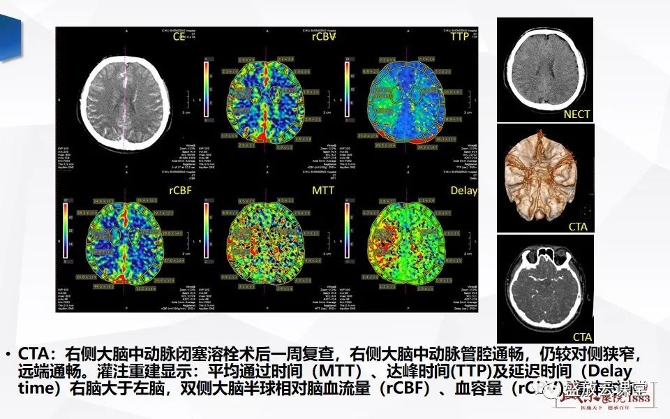 影像PPT - 【PPT】脑CT灌注成像中各测量值的意义-16