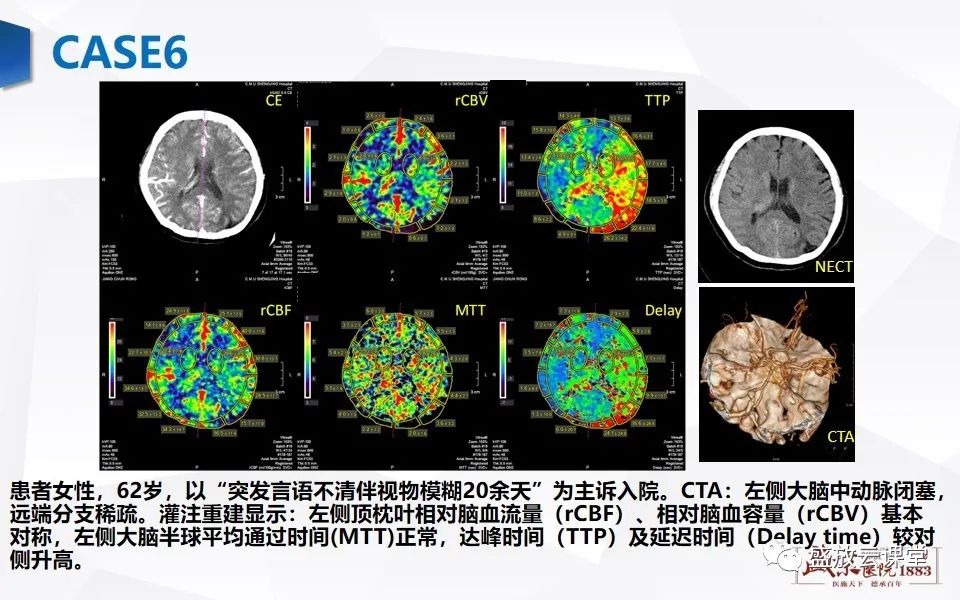 影像PPT - 【PPT】脑CT灌注成像中各测量值的意义-18