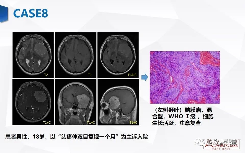影像PPT - 【PPT】脑CT灌注成像中各测量值的意义-20
