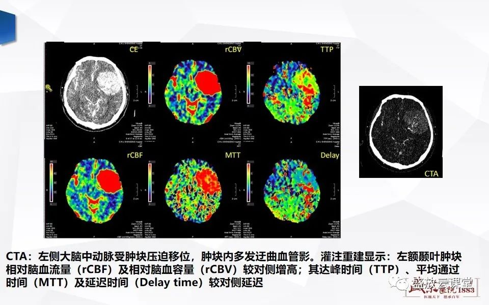 影像PPT - 【PPT】脑CT灌注成像中各测量值的意义-21