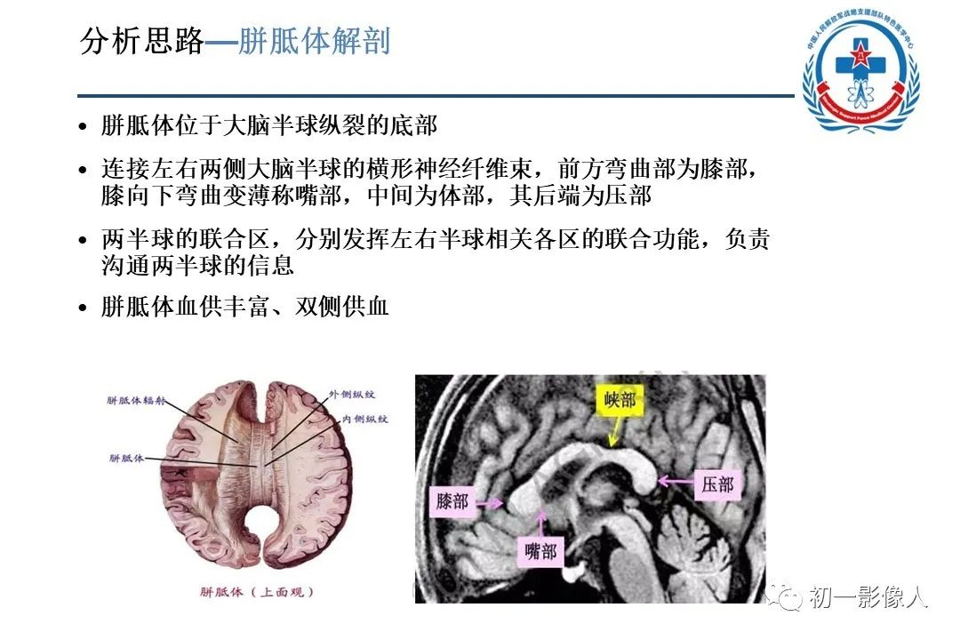 影像PPT - 【PPT】原发性胼胝体变性MBD-7