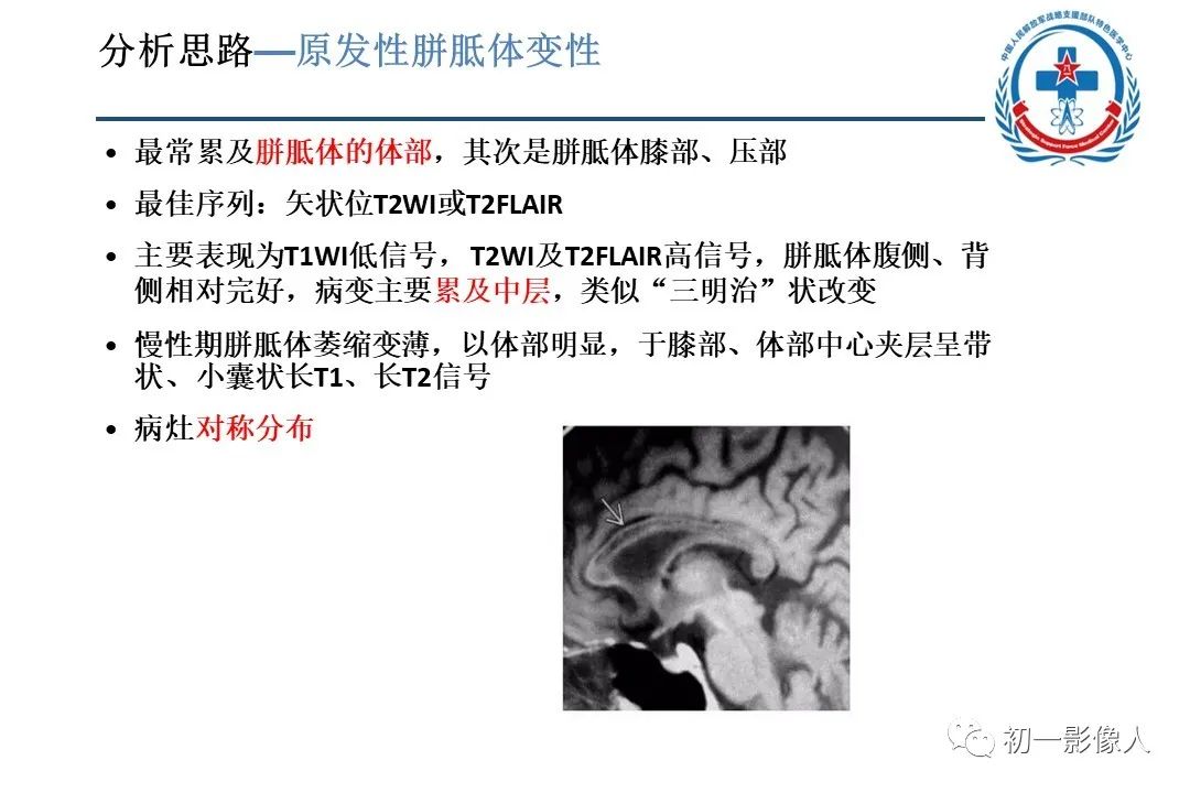 影像PPT - 【PPT】原发性胼胝体变性MBD-11