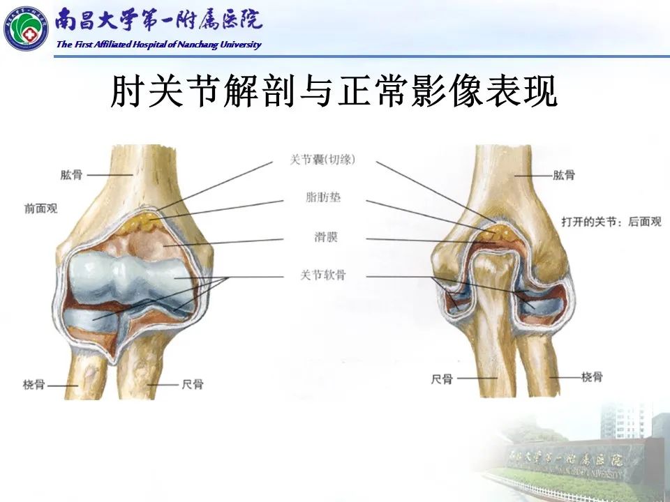 影像PPT - 【PPT】儿童肘关节骨折X线诊断-6