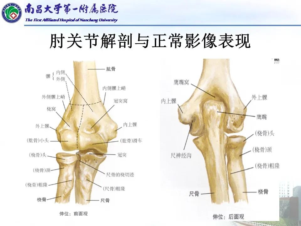影像PPT - 【PPT】儿童肘关节骨折X线诊断-7