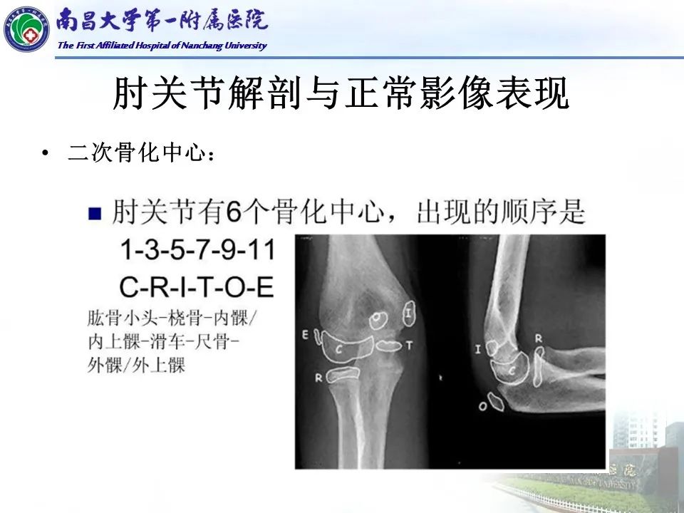 影像PPT - 【PPT】儿童肘关节骨折X线诊断-10